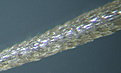 Нажмите на изображение для увеличения.

Название:	micr_op_leptocantha_spine_P1190032.jpg
Просмотров:	201
Размер:	39.0 Кб
ID:	381024
